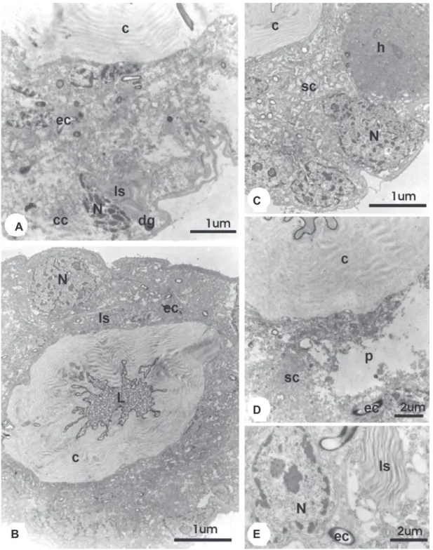 Figure 6. TEM micrographs of the venom gland of  25 day-old workers of A. mellifera from the group treated with juvenile hormone (HJ group) and the control  with the hexane treatment (C2 group)