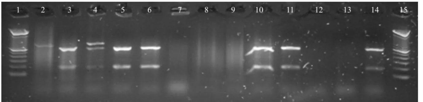 Fig 2 Genotypes patterns of REX-1 amplified products followed by restriction with  Taq1 