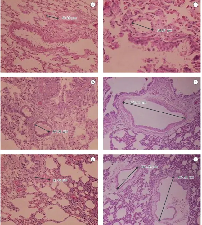 Figura 1 - Fotos de microscopia das amostras de tecido pulmonar coradas com hematoxilina e eosina: a) controle; 