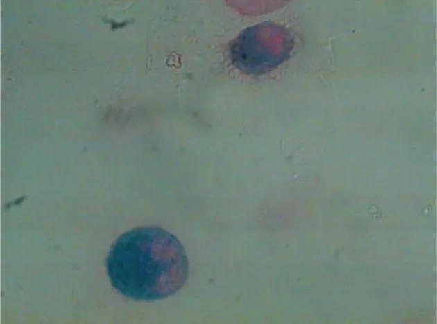 Figura 2 - Microscopia óptica do lavado broncoalveolar 