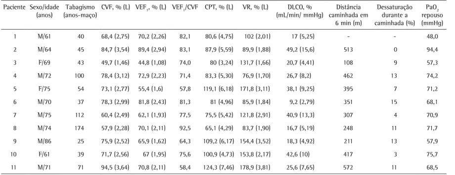 Tabela 1 - Principais características dos 11 pacientes diagnosticados com enfisema em lobos superiores e alterações compatíveis com fibrose pulmonar idiopática em 