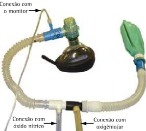 Figura  1-  Esquema  para  o  uso  do  óxido  nítrico  por 