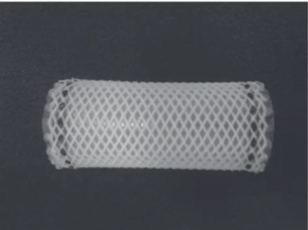 Figura 1 - Exemplo de endoprótese auto-expansível de  malha de poliéster revestida por silicone (Polyflex ® ).