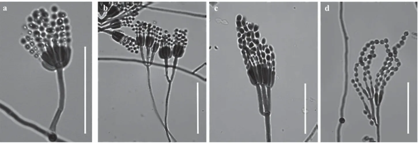 Fig 2 Microscopic characteristics of: a) Penicillium sclerotiorum (detail of conidiophore: stipes, metulae and disposition to  conidia); b) Penicillium melinii (conidiophore with phialides); c) Penicillium oxalicum (detail of conidiophore: stipes, phialide