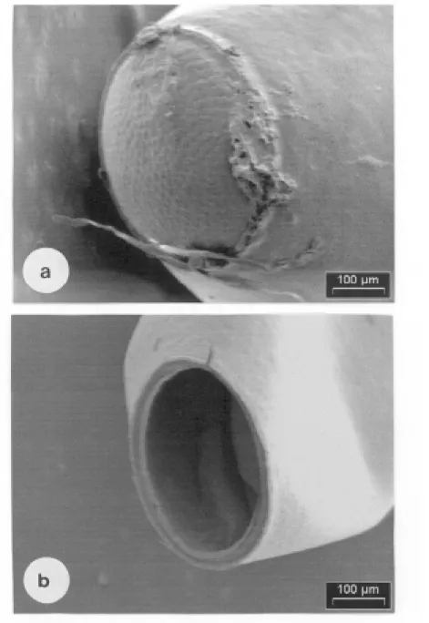 Figura 2: Aspecto general de la zona cefálica del huevo de T patagonica.