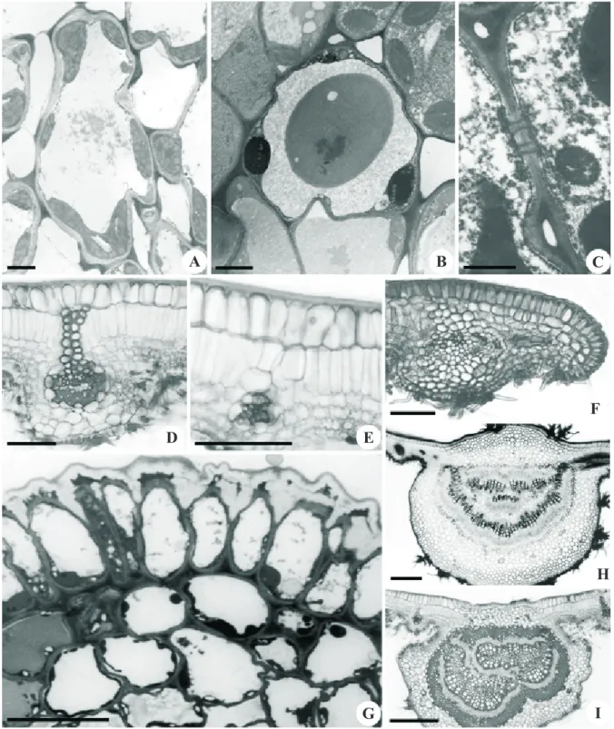 Figure 2. Aspects of paraheliotropic and diaheliotropic leaves of Styrax camporum. A. Spongy parenchyma cell with prominent chloroplasts