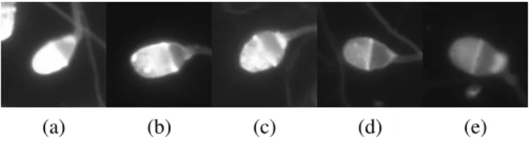 Figure 2.2: Different stages of acrosomal reaction of different human spermatozoa, where reaction occurs from left to right: a) capacitated, b-d) reacting and e) reacted