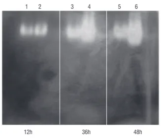 figure 3. CAT gel activity analysis in maize seeds soaked in distilled water (lines  1, 3, and 5) or 100 mM H 2 O 2  solution (lines 2, 4, and 6) for 12, 36, and 48 h.