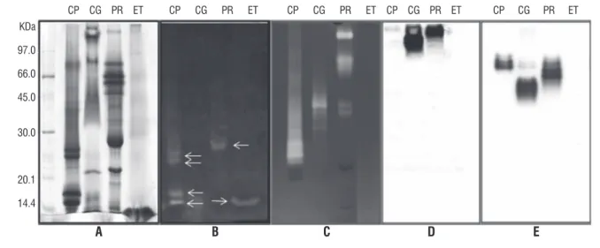 figure 2. Detection of Chitinase (B), Proteinase (C) and Peroxidase activities (D and E) in gel