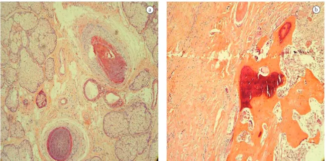 Figura 3 - a) Glândulas sebáceas e folículo piloso; b) Parênquima ósseo.