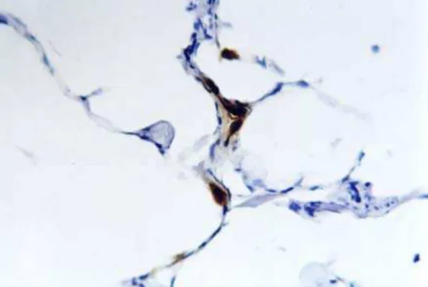Figura 2 - Marcação de subtipos celulares de linfócitos T