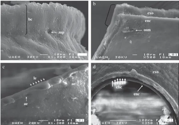 Fig 2 Detalles de la región opercular de huevos de Triatoma barberi estudiados por MEB