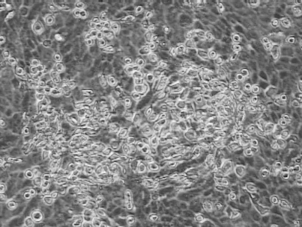 FIGURA 5: Efeito citopático da amostra EVI-190 (BHV-5) isolada de cérebro, 24 horas  após infecção em células MDBK
