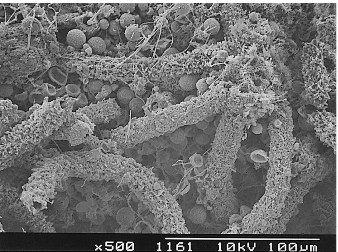 Fig.  1.4.  SEM  image  of  Scytomena  julianum  mat.  The  calcified  sheaths  are  composed  of  triradiate  calcite crystals