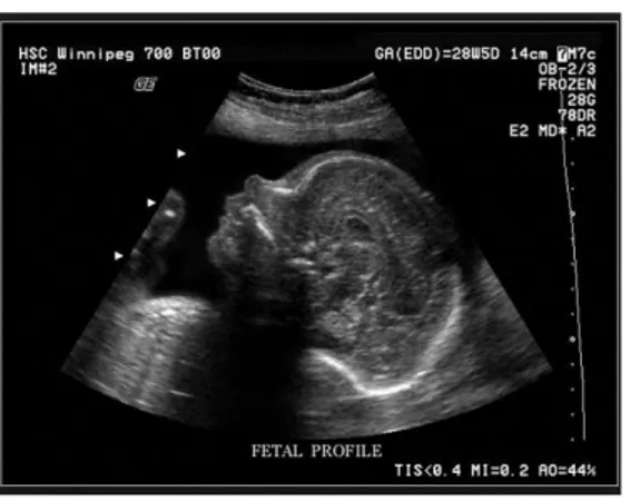 Figura 3.2 Ecografia fetal. (retirado de http://visualmed.usal.es/?page_id=175).  