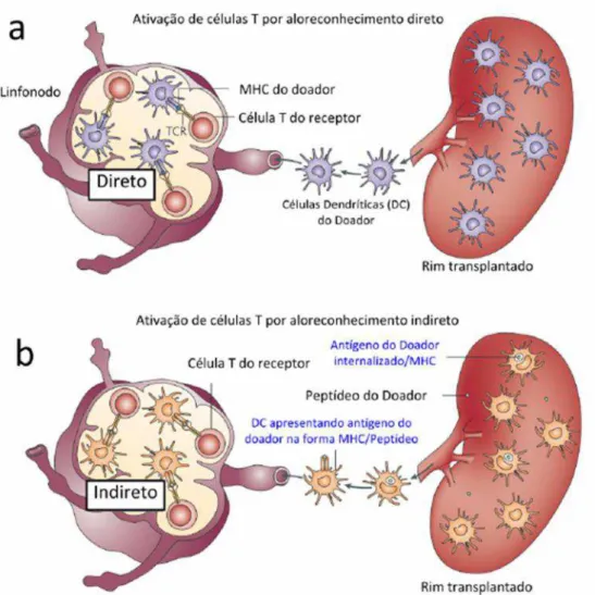 Figura  1. Resposta  imune  aos  transplantes. TCR, receptor  de  célula  T;  MHC,  complexo  principal de