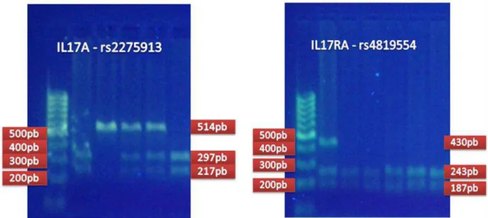 Figura 3. Gel  de  eletroforese  em  agarose  a  2%  após  PCR-RFLP  para  os  polimorfismos  estudados  nos genes IL17A e IL17RA