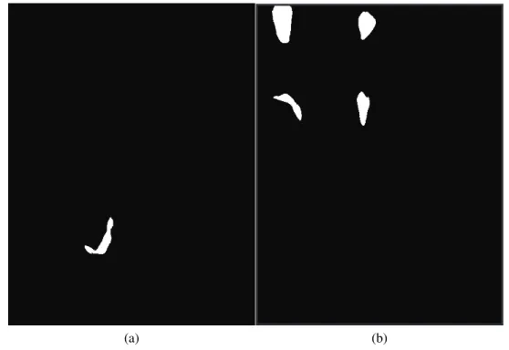 Figura 10 – Máscaras iniciais. 10a e 10b foram obtidas a partir das imagens 9a e 9e, respectiva- respectiva-mente.