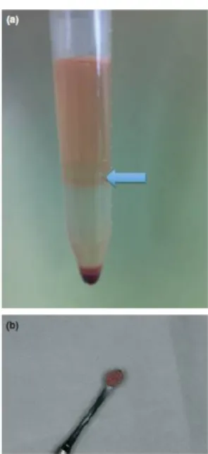 Figura  4:  tubo  de  propileno  após  centrifugação  do  gradiente  de  densidade.  (a)  Notar  fração  mononuclear (seta); (b) Fração  mononuclear da medula óssea misturada ao Bio-Oss