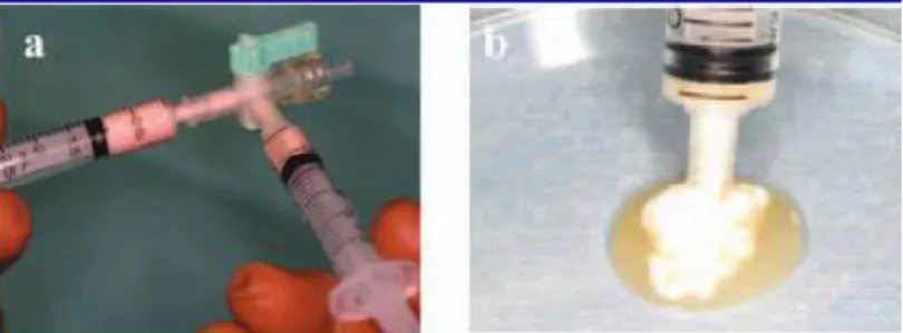 Figura  5: preparação  do  osso  injetável.  (a)  Procedimento  de  mistura  dos  componentes;  (b)  Forma de aplicação clínica