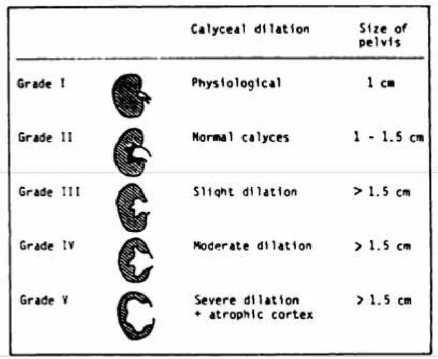 Figura 3 - Classificação da dilatação do trato urinário fetal após 20 semanas de gestação 