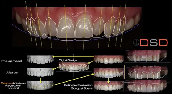 Figura 16. Digital Smile Design (DSD) - um programa utilizado em Medicina  Dentária Estética baseado em fotografias digitais