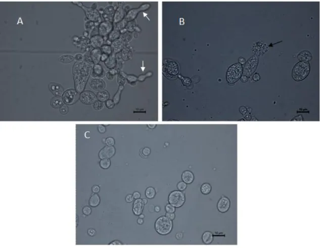 Figure  2:  Analysis  by  optical  microscopy  (100x)  of  Paracoccidiodes  brasiliensis  Pb  18  after treatment with  ¼ MIC (A) and  ½ MIC (B) of cytochalasin E  after incubation  for 7  days  in  yeast  peptone  dextrose  medium  at  37ºC  compared  to 