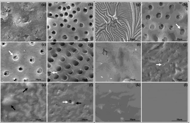 Fig.  5  -  SEM  micrographs  depicting  the  most  common  features  of  dentin  surfaces  after  treatment  and  after  acid  challenge  with6%  citric  acid