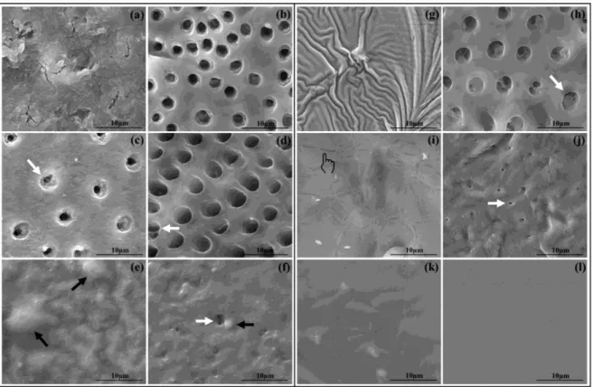 Fig.  5  -  SEM  micrographs  depicting  the  most  common  features  of  dentin  surfaces  after  treatment  and  after  acid  challenge  with6%  citric  acid