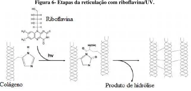 Figura 6- Etapas da reticulação com riboflavina/UV. 