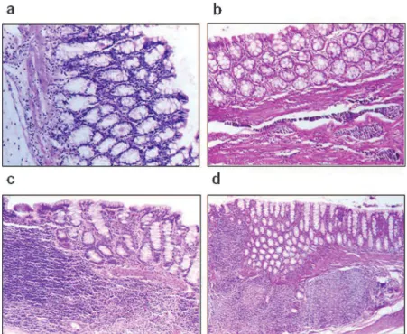 Table 2 - Cell types, assessment of lymphoid follicles of mucous associated lymphoid tissue (MALT), and