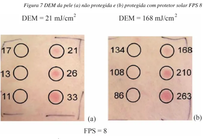 Figura 7 DEM da pele (a) não protegida e (b) protegida com protetor solar FPS 8 