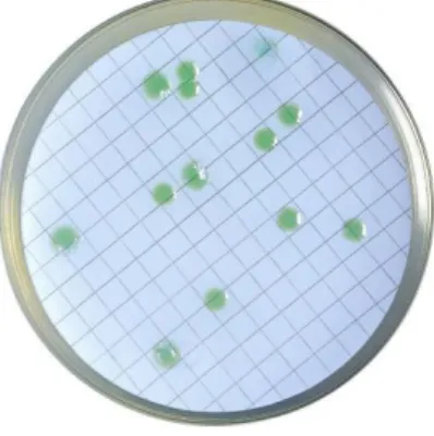 Figura 5: Colônias características de Enterococcus 
