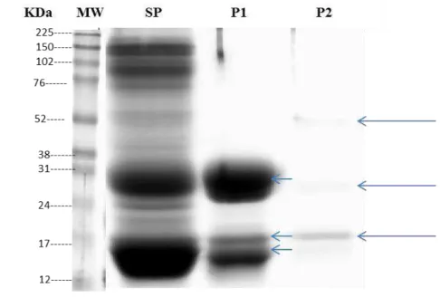 Figura 5 - SDS-PAGE 1-D com proteínas ligadas e não ligadas à heparina, em que as setas em azul  apontam a presença de 3 bandas proteicas com pesos moleculares entre 14 kDa e 24 kDa na fração  P1, e 3 bandas proteicas com pesos moleculares entre 15 kDa e 5