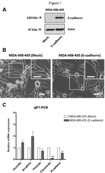 Figure  1.    Effects  of  exogenous  E-cadherin  on  the  cell morfology  and  expression  of  epithelial  and  mesenchymal markers  in  MDA-MDA-435  cells