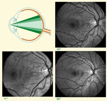 Figure 2.4: Examples of fundus photography using 40 ◦ , 20 ◦ and 60 ◦ FOV [13].