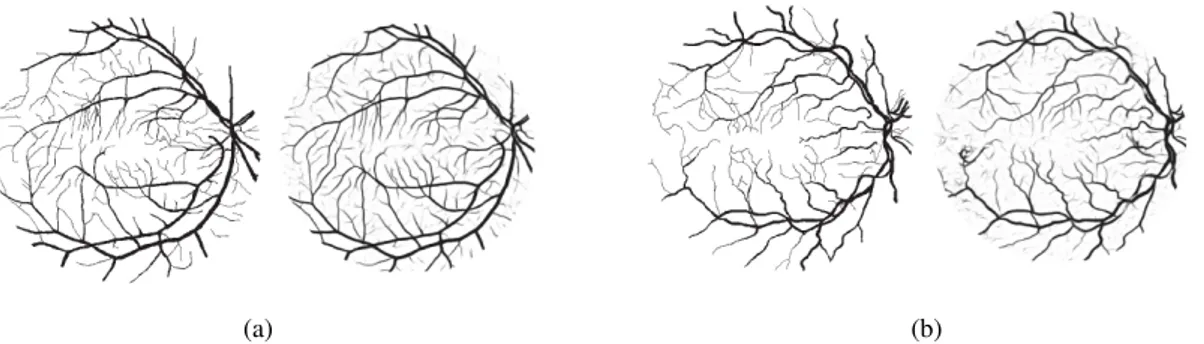 Figure 3.9: Example of Train- Train-ing patches after applyTrain-ing ZCA whitening transformation [51].