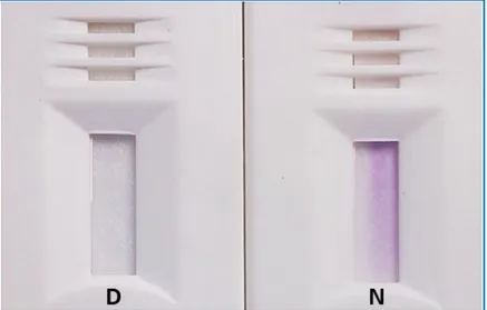 Figura  16.  Resultados  do  teste  visual  para  a  deficiência  em  glicose-6-fosfato  desidrogenase  (G6PDd)  por  teste  de  diagnóstico  rápido  (RDT):  a  cor  púrpura  indica  um valor normal da G6PD (N) e a ausência de cor assinala a deficiência em