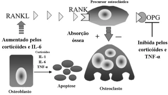 Figura  1:  Efeito  das  citocinas  pró-inflamatórias  e  dos  corticosteroides  na  osteoclastogénese