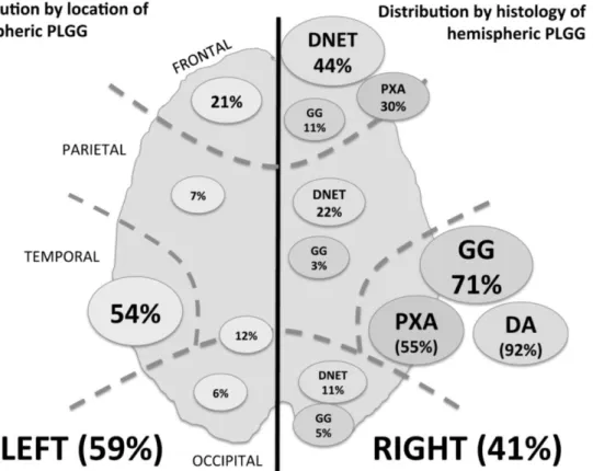 Figura 1 – Distribuição tendo em conta a localização e subtipos histológicos dos gliomas de baixo grau pediátricos  (PLGG)  hemisféricos