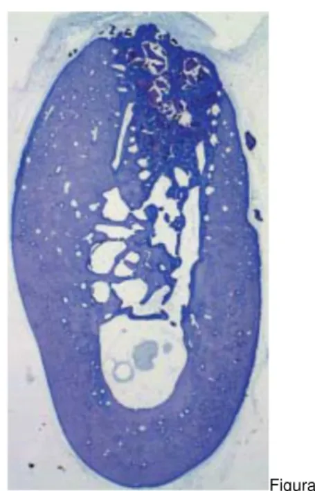 Figura 11. Foto micrografia de uma seção vestíbulo-lingual que representa área não enxertada