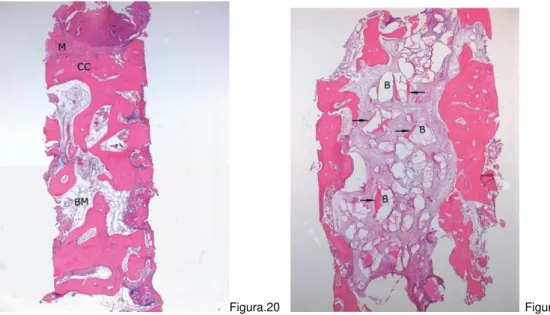 Figura 20. Fotomicrografia de um local de controle não-enxertada a partir de uma região de molar após 6 meses de cicatrização