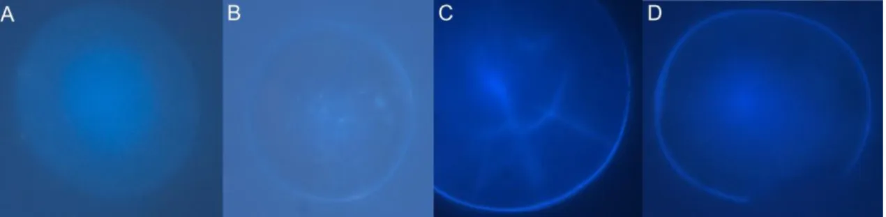 Fig. 6: Photographs of otoliths from L. lepadogaster larvae, using a fluorescence microscope with the WU filter