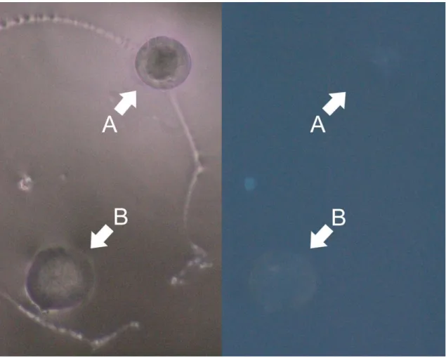 Fig. 8: Photographs of otoliths from L. lepadogaster larvae, taken using a fluorescence microscope