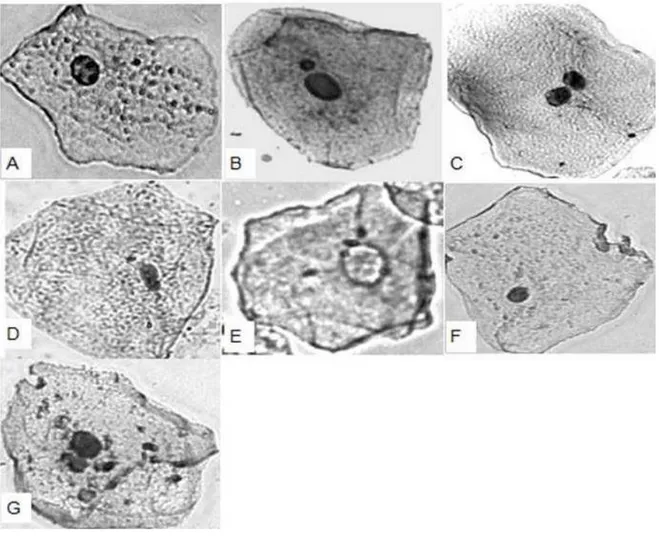 Figura 6 –  Células de mucosa oral de  doadores de Lucrécia com núcleo normal  (A),  micronucleado (B), binucleado (C), brotamento  nuclear  (D), cariolíse (E),  piquinólise (F) e fragmentado (G)