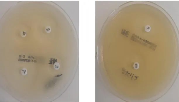 Figura 12- Placas contendo o agar Mueller-Hinton e os discos de antibióticos 