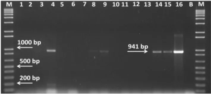 Figure 7 -Example of the species PCR-amplification. Lanes: 1 to  15, meat-enterococci; 15, E