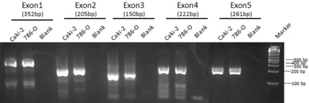 Figure 11. 2% Agarose gel showing the PCR products of exon 1 (352 bp), exon 2 (205 bp), exon 3 (150  bp), exon 4 (222 bp) and exon 5 (261bp) of GRIM-19 from two clear cell RCC cell lines (Caki-2 and  786-O)