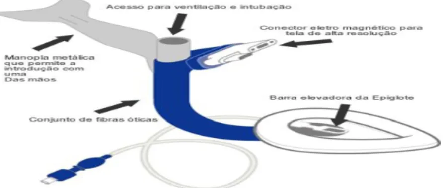 Figura nº 13: Máscara laríngea C- Trach (fonte : http://www.nalean.com.br//lma.htm) 