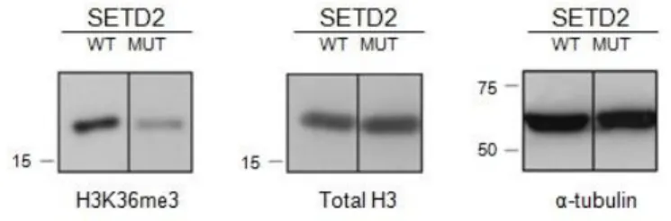 Figure 4 SETD2 activity is reduced in mutant ccRCC  